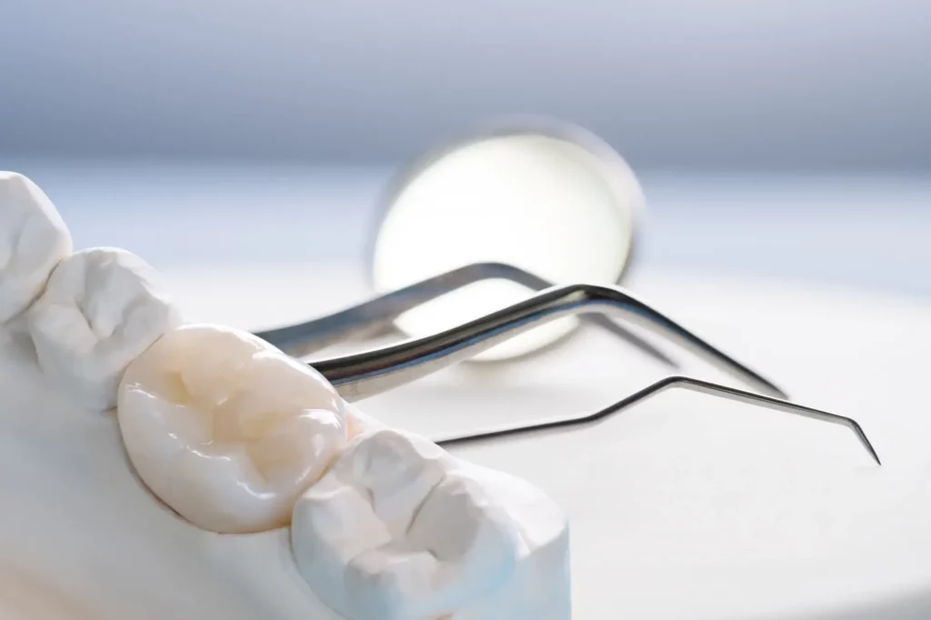 Dental Crown (1) When a dental crown is needed