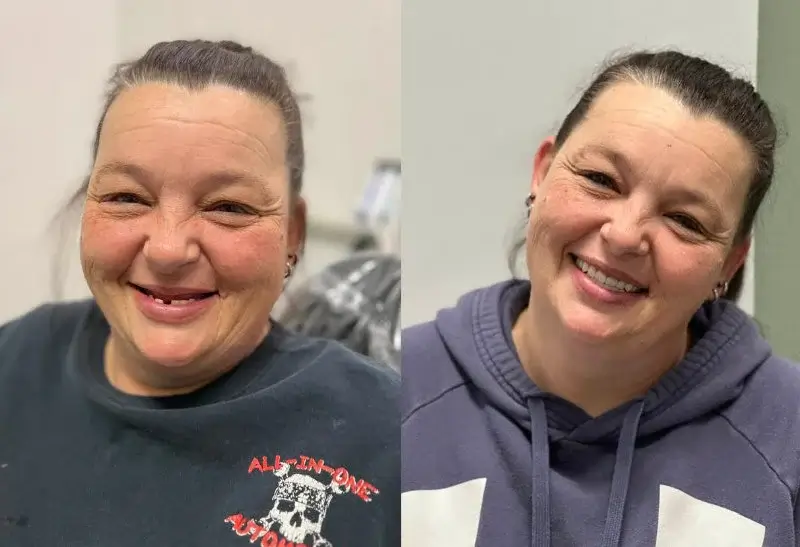 Dentist Yukon Before and After