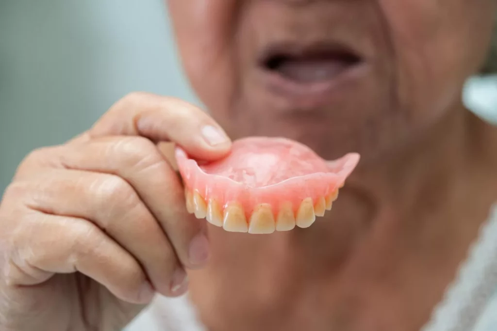 Common: Woman with bad dentures