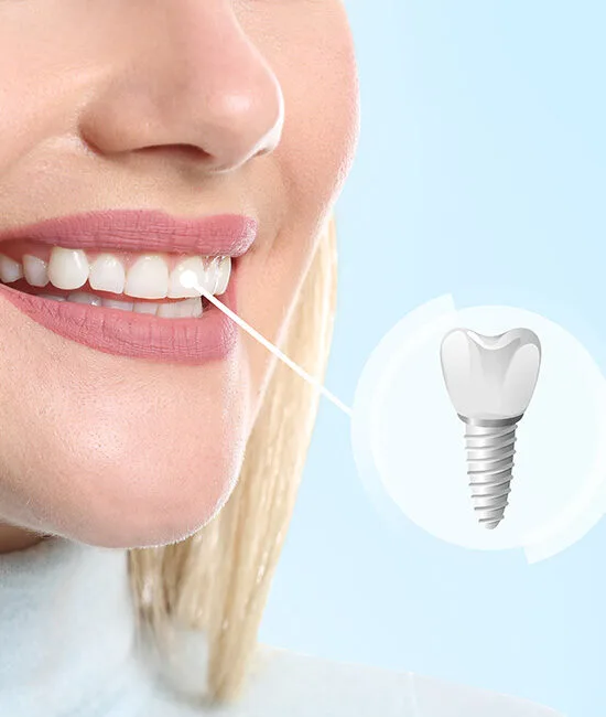 Dentist explaining tooth replacement options for families dealing with missing teeth
