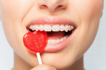 Sticky candies and sweets shown as foods that damage teeth and cause tooth decay