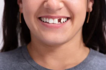 Loose teeth and bite changes as early signs you need to visit a dentist for evaluation