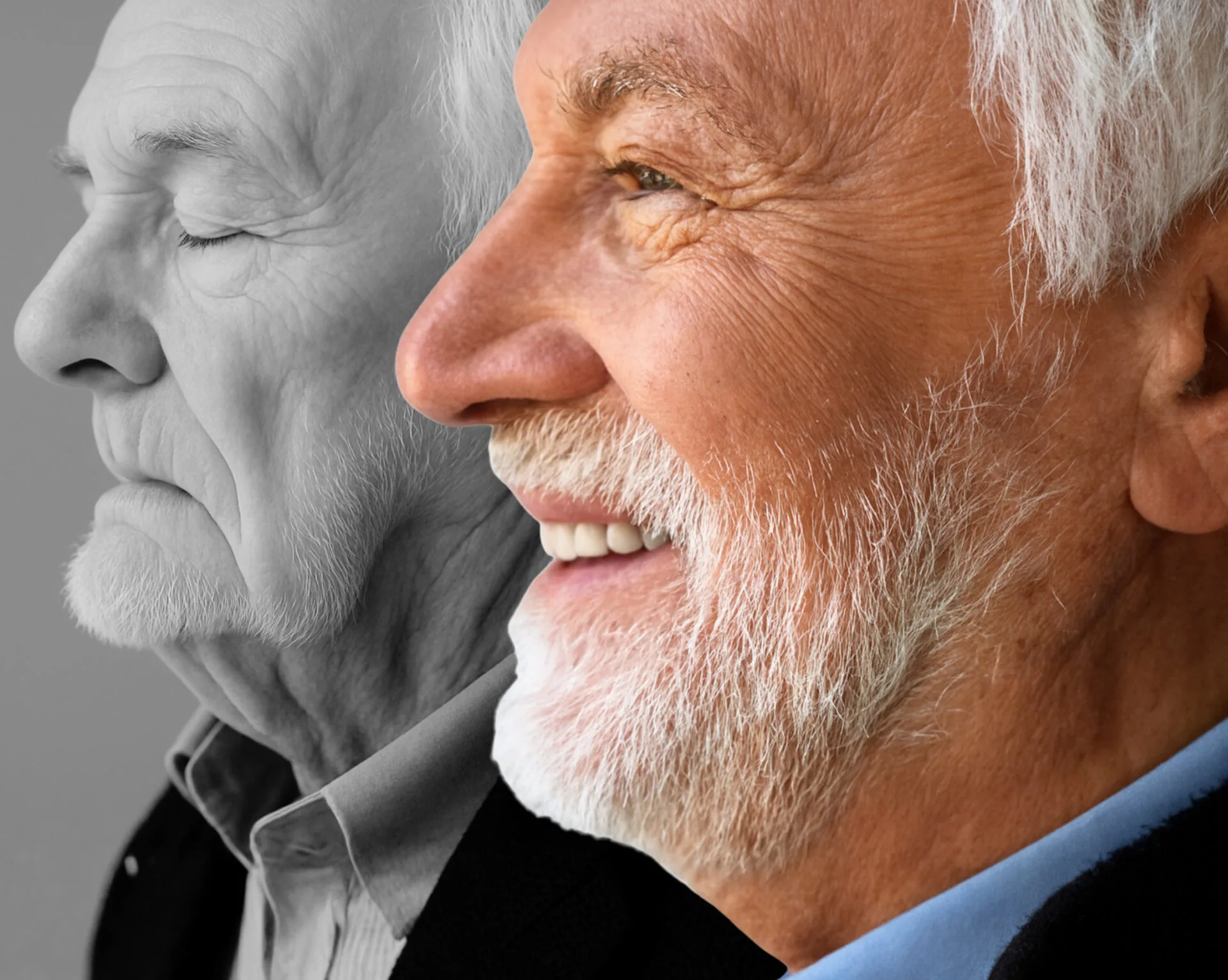 With and Without Dental Implants