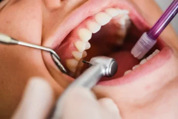 The Rise of Oral Nicotine Use and How it Might Affect Your Oral Health 6 Dental checkup focused on protecting oral health from effects of oral nicotine