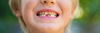 Restorative dentistry treatment plan for improving smile upgrade Yukon OK patients