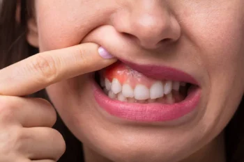 Educational dental graphic highlighting warning signs you shouldn’t ignore this February for healthy smiles healthy hearts