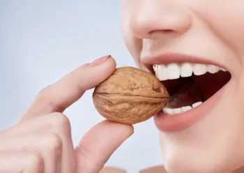 Diet and Oral Health: Best & Worst Foods for Your Teeth | Redeemed Smiles 4 Healthy foods for strong teeth and gums supporting diet and oral health