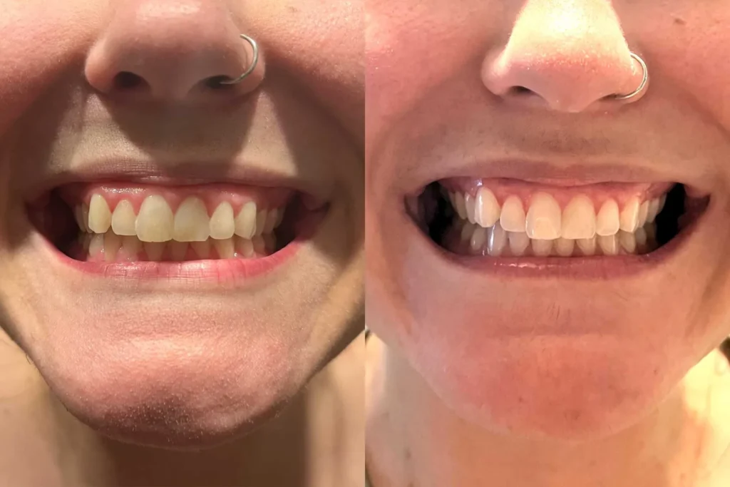 Patient scheduling dental appointment online with dentist near Oklahoma City OK clinic