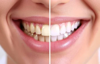 Patient showing brighter smile after professional teeth whitening treatment by Dentist Mustang OK