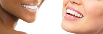 Close-up of whiter teeth results from Teeth Whitening Yukon OK dental procedure
