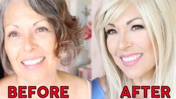 How a Full Smile Makeover Can Transform More Than Just Your Teeth 7 Patient showing a confident and youthful smile after a full smile makeover treatment