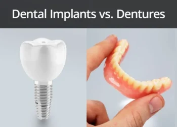 Dental Implants Yukon OK: What to Expect Step by Step 4 implant-supported dentures and dentures Yukon OK comparison