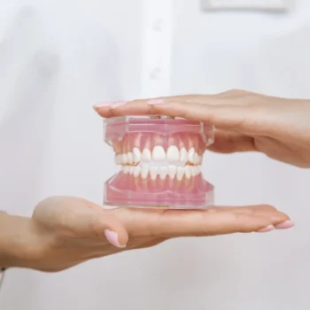 How Dental Implants Restore Smile Confidence in Yukon, OK 4 A professional displaying a clear dental model of a full set of teeth.