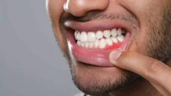 Why Regular Dental Checkups Matter More Than You Think 4 Regular Dental Checkups Help Prevent Gum Disease That Can Affect More Than Your Smile