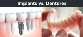 Dental Implant Success Story: How Lori Rediscovered Her Smile 3 Dental Implant Success Story: Comparing Dental Implants or Dentures