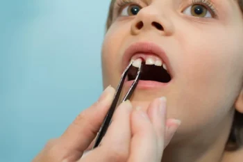 The Impact of Tooth Loss