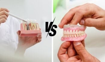 Implant-Supported Dentures vs. Traditional Dentures