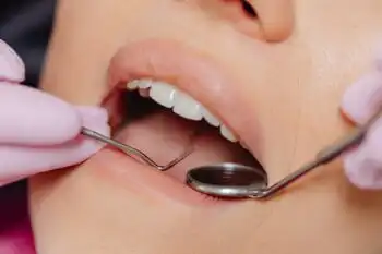 Dental Checkup