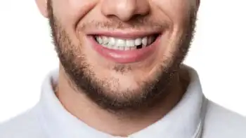 missing teeth