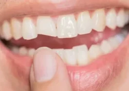 Emergency Dentist Yukon OK